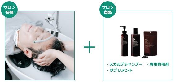 バイオテックの育毛プラン（ライトプラン）