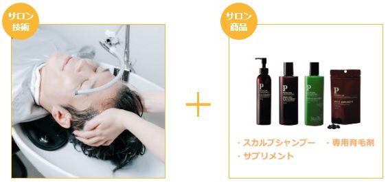 バイオテックの育毛プラン（ミドルプラン）